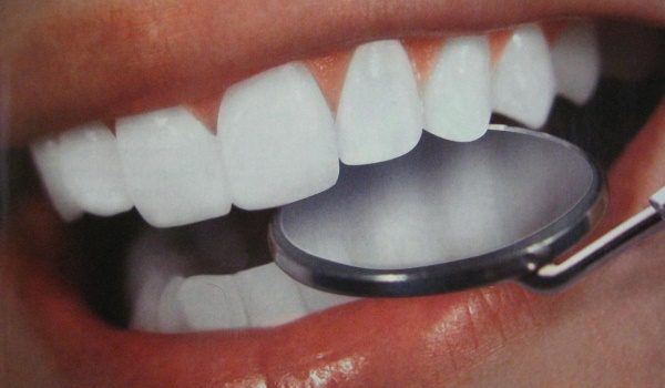 Как быстро отбелить зубы без вреда в домашних условиях