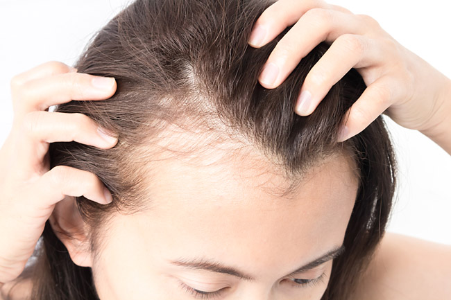 Какие заболевания провоцируют выпадение волос у женщин Фото 2