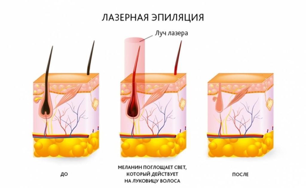 Механизм воздействия на меланин