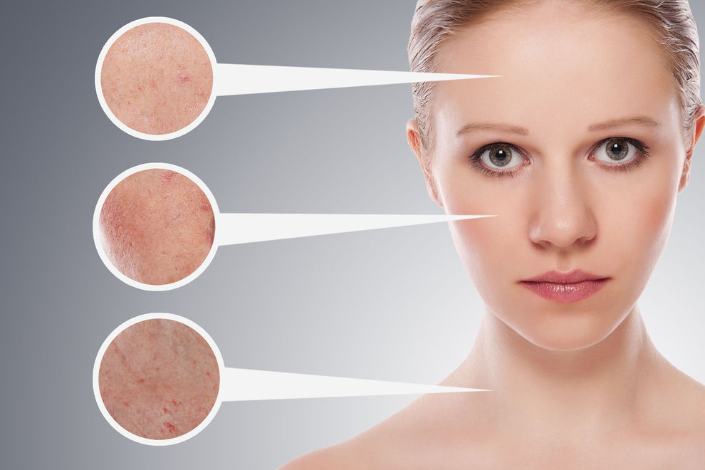 Особенности антивозрастного ухода за проблемными типами кожи
