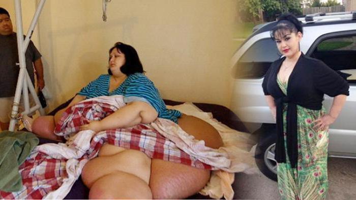 очень толстые люди которые похудели фото до и после