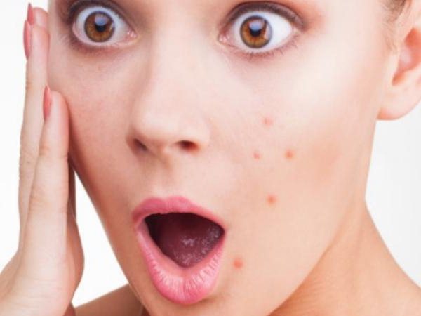 сыпь на лице у женщин причины кожной сыпи
