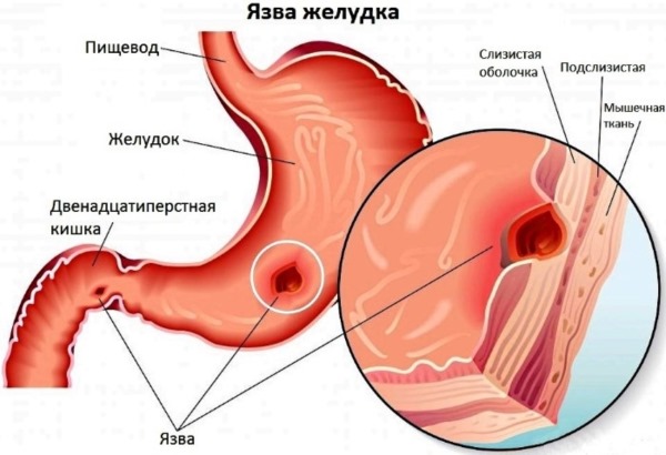 Медовая вода натощак. Плюсы и минусы, как приготовить с корицей, для похудения, пить по утрам, на ночь