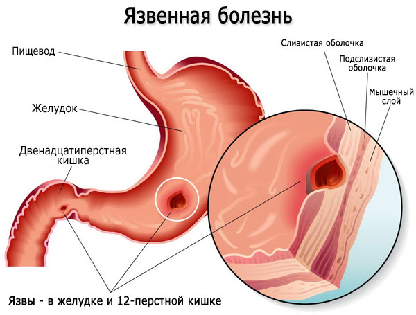 Настой шиповника. Польза и вред, как заваривать в термосе, рецепты применения для печени, почек, детям, беременным