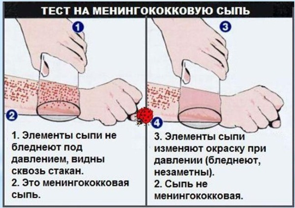 Мелкие пупырышки, сыпь на руках, ногах, голове, спине. Что это такое, как лечить