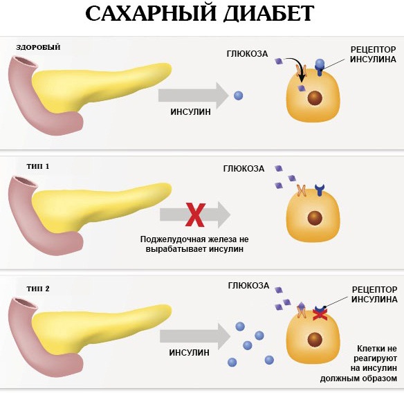 Мелкие пупырышки, сыпь на руках, ногах, голове, спине. Что это такое, как лечить