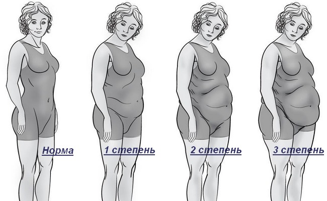 Классификация ожирения по индексу массы тела (ИМТ)