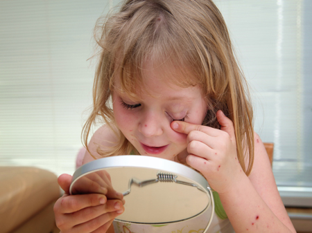 Сыпь у ребенка: что это? Аллергия, инфекция или укусы насекомых?