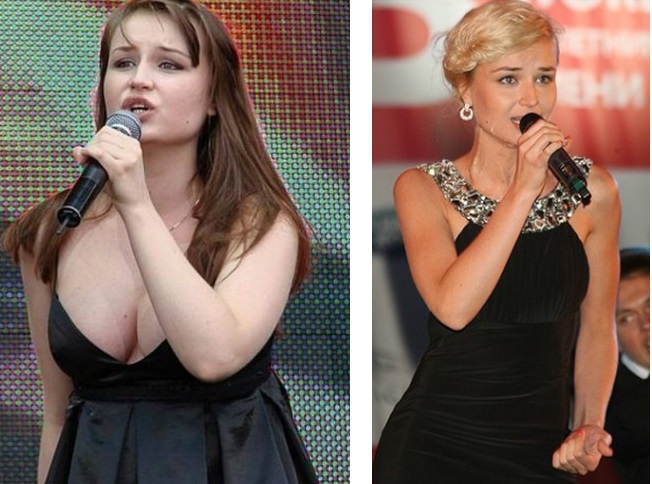 Полина Гагарина до и после похудения
