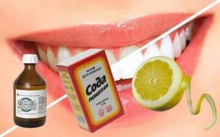 сода для відбілювання зубів