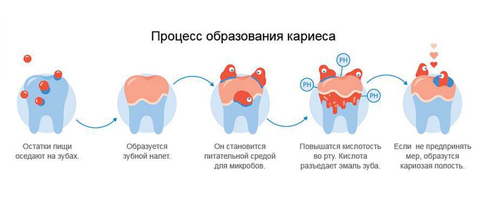 Не забывайте чистить зубы минимум два раза в день. Фото предоставлено пресс-службой ООО «АРКОМ» 