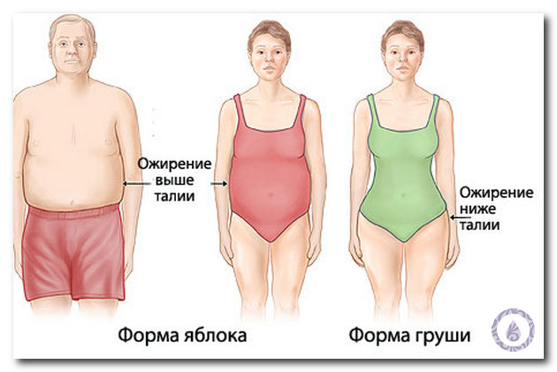 ожирение 2 степени у женщин