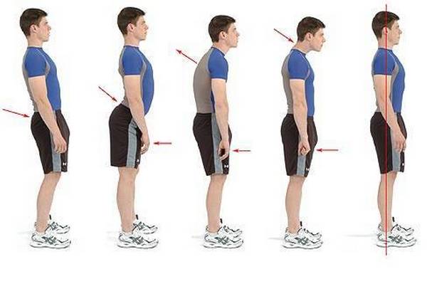 Определить искривление осанки довольно просто – человек может увидеть ее даже в зеркале