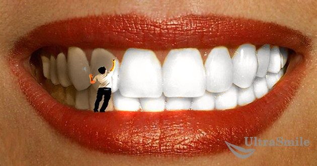 Можно ли провести отбеливание зуба изнутри