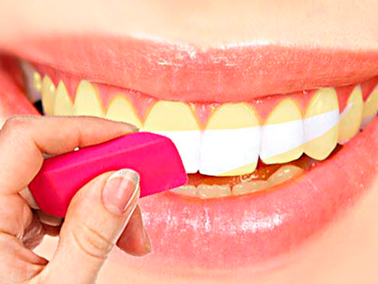 8 советов, как отбелить зубы дома без вреда для эмали