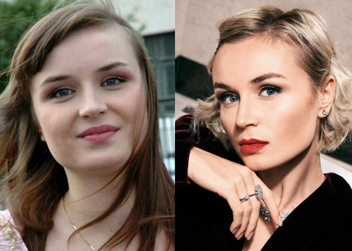Известная певица красавица Полина Гагарина до и после удачной многочисленной пластики лица и похудения фото