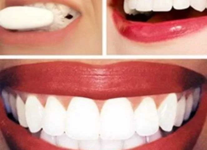 ﻿Как отбелить зубы домашними средствами за 20 минут