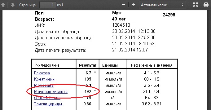 анализ крови на мочевую кислоту