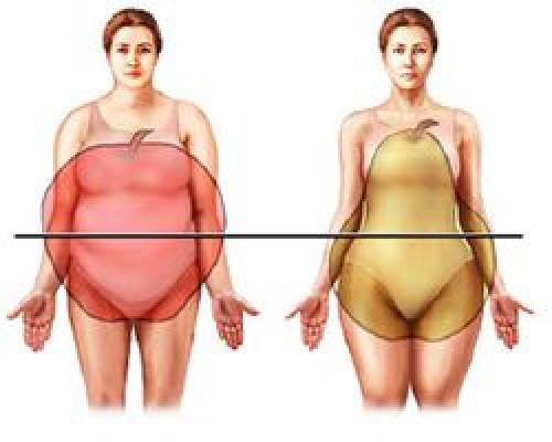 Ожирение виды. Типы ожирения