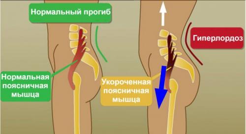 Зачем садиться на продольный шпагат