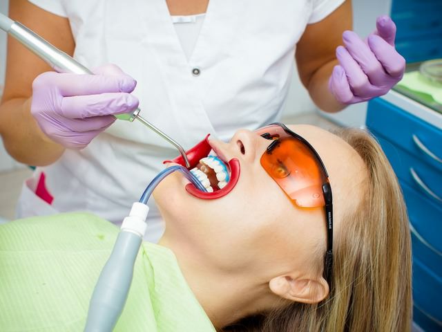 Отбеливание зубов специальными препаратами